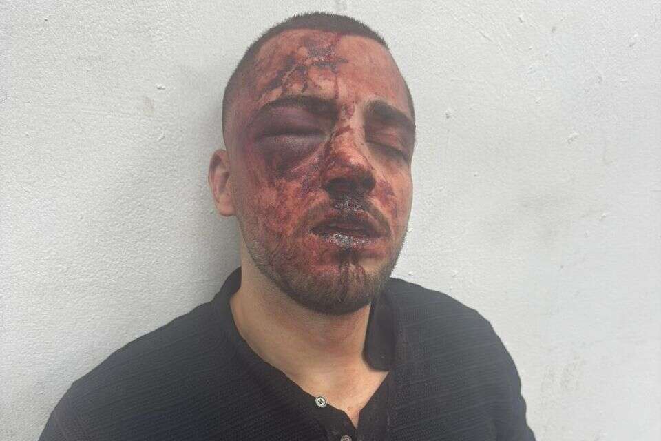 הפרקליט הפצוע , ללא קרדיט