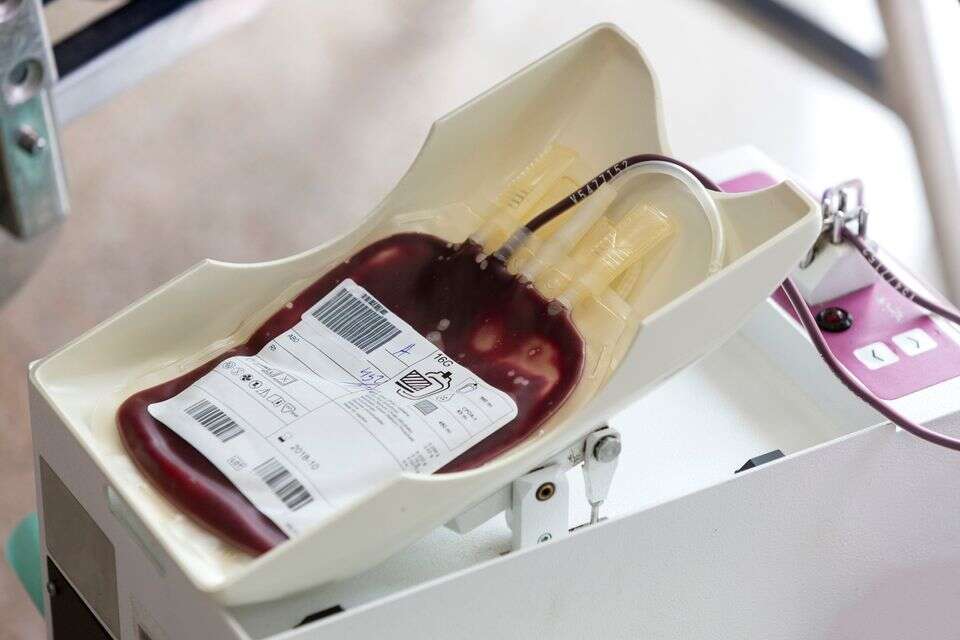 בעלי סוג הדם הזה בסיכון גבוה יותר לשבץ מוקדם