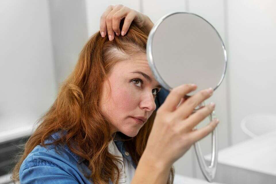 קרחות קטנות לצד שיער לבן? כדאי לפנות לרופא עור , Pexels
