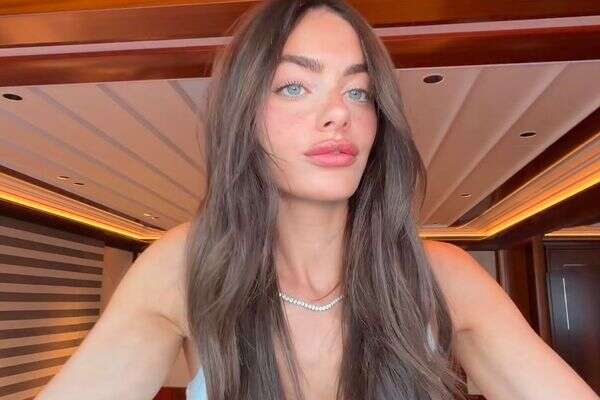 התפרצות בפנים. יעל שלביה , אינסטגרם