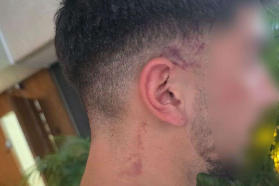 הצעיר שהותקף , ללא
