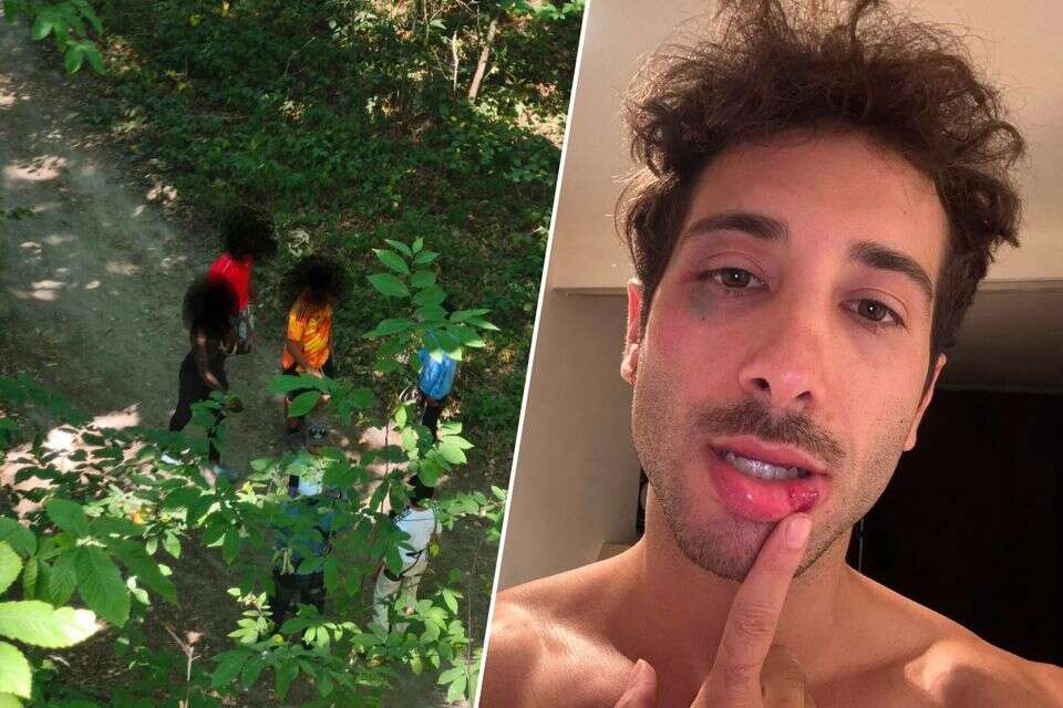 תומר אחרי התקיפה, משמאל - התוקפים , ללא