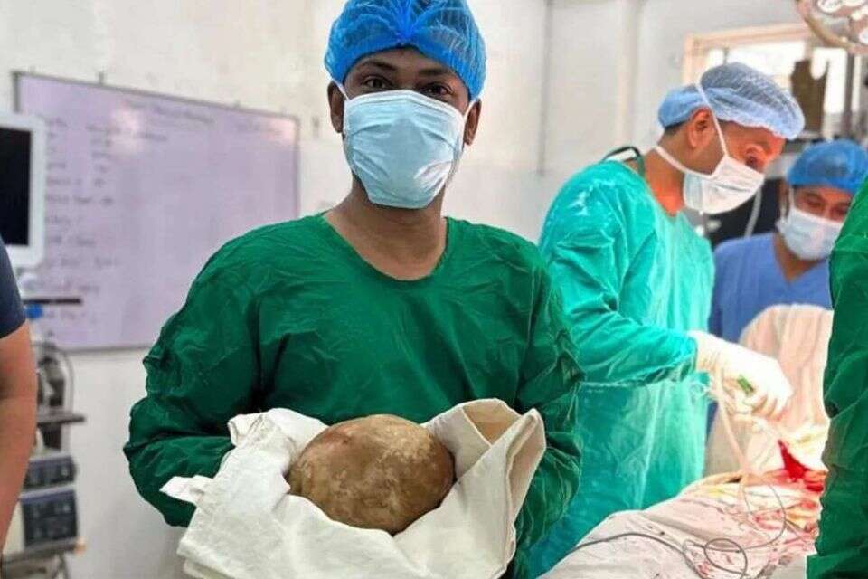 האבן הענקית שהוצאה משלפוחית השתן של החולה , רשתות חברתיות