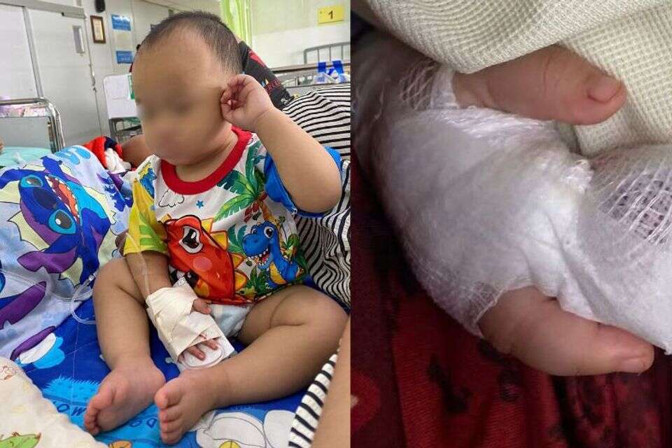 תאונה קשה: כרת את האצבע של בן השנה , פייסבוק