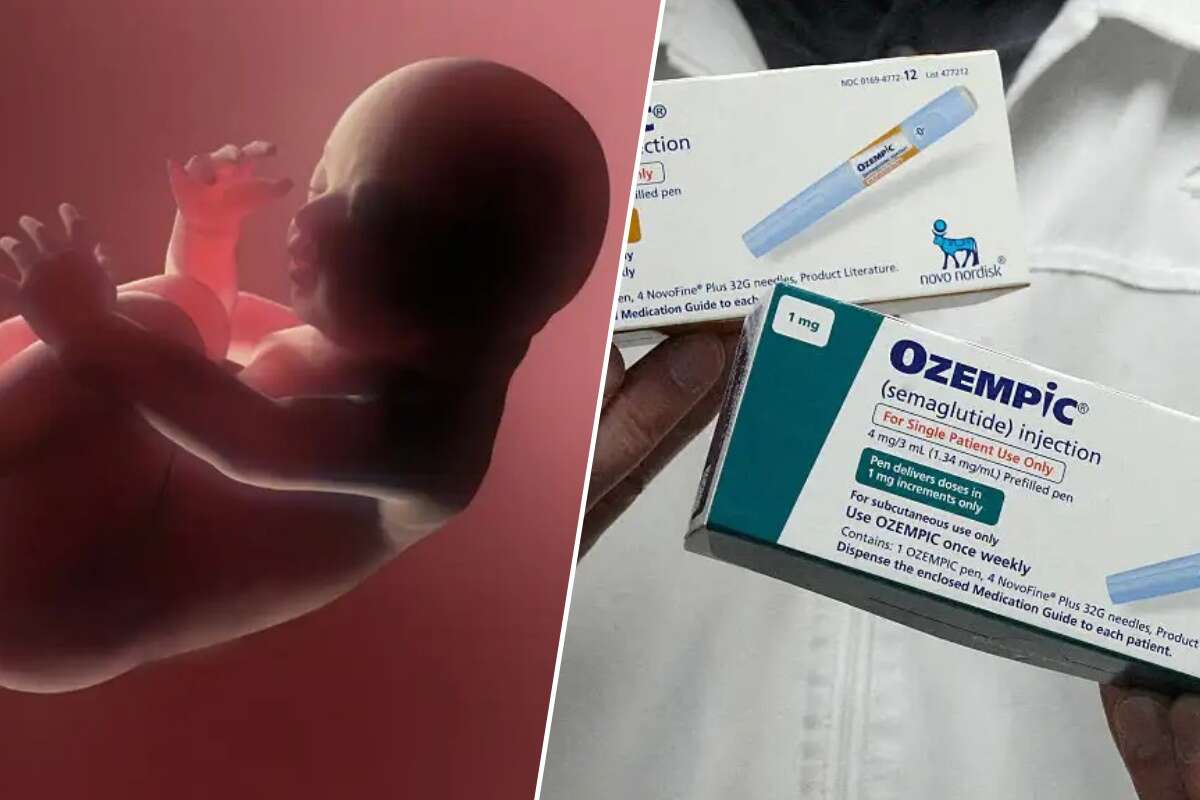 New study examines the effect of weight-loss drugs on pregnant women
