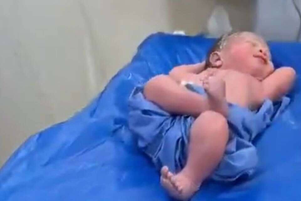 התינוק בתנוחה במיוחדת , X