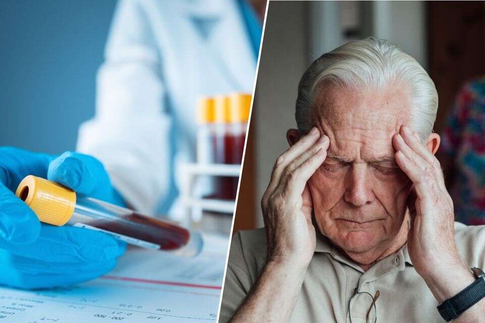 בדיקת דם עשויה לחזות דמנציה , Getty images